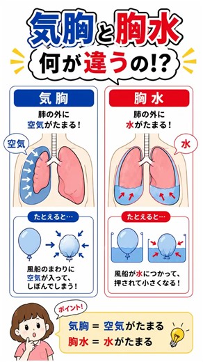 気胸と胸水の違い！【1分で解説】