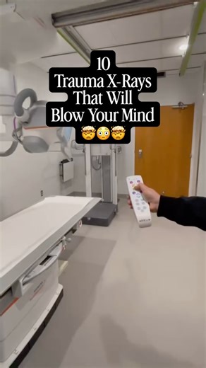 radiographer on Instagram: "😱 That LAST one is …. . . . probably one of the wildest x-rays I’ve ever seen in the radiology department and hospital emergency trauma medicine. As a Radiographer aka radiologic technologist aka x-ray technologist we are always on the frontlines of emergency medicine. Whether it’s a STAT x-ray, CT, MRI, Ultrasound, Nuclear Medicine, or one of so many other medical imaging modalities, we help find out was is going on INSIDE of hospital patients so we can help get the