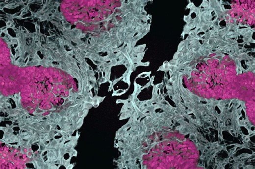 Mini-Lungs Built From Stem Cells