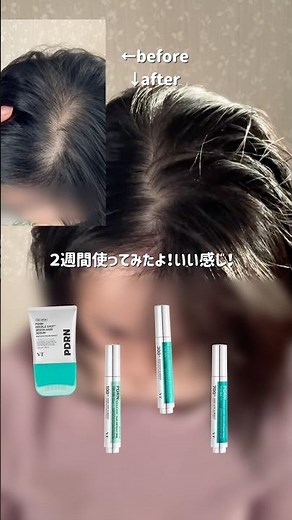 【検証🔍】薄毛さん必見！2週間で髪の毛が元気に！？vtcosmeticsのヘアケアラインを使ってみた💡