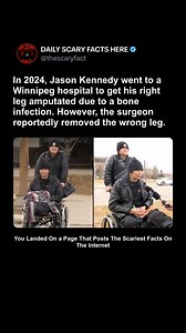 In 2024, Jason Kennedy entered a Winnipeg hospital expecting to have his right leg amputated due to a serious bone infection. However, a devastating mistake occurred in the operating room: surgeons amputated his healthy left leg instead. Wrong-site surgeries are considered among the most catastrophic errors in medicine, often categorized as "never events" because they are theoretically preventable through rigorous protocols. Following the error, Kennedy was forced to undergo another surgery to a