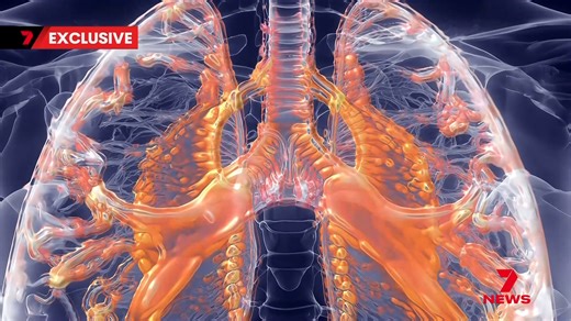 147K views · 1.2K reactions | The TGA has approved a next-generation cystic fibrosis treatment for the 4,000 Australians living with the genetic condition. | 7NEWS Sydney | Facebook