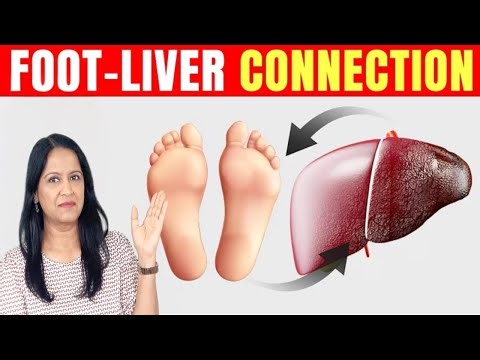 Do NOT Ignore These Foot Symptoms —They Point to Liver Problems | Liver Damage Starts With Your Feet