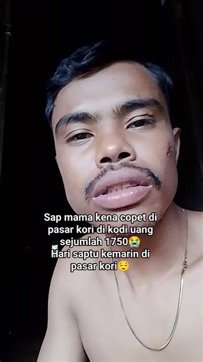Sap mama kena copet di kodi😌🙏 Tapi tidk apa" Tuhan tidk buta mama Tuhan pasti blas dngn rejeki yng berlipat😌 | Alen Andoko