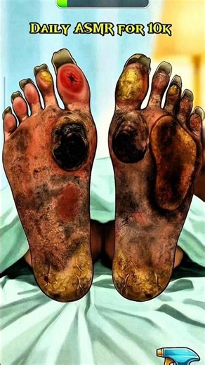 Extreme Foot Cleaning ASMR 🦶 Satisfying Dirty Feet Cleanup #asmr #shorts