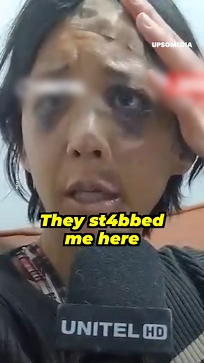 She only asked for silence to sleep. And they left her like a rag doll. This Bolivian woman tells how she ended up after confronting some noisy women who were partying. | The Enigma