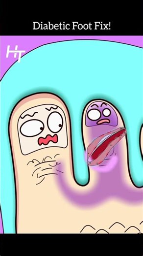 Stop Ignoring Foot Sores! How Doctors Save Limbs from Diabetic Ulcers #shorts