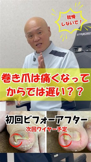 【Is it an ingrown toenail just because it hurts⁉️ Wrong‼️】 An ingrown toenail isn't defined by pa...