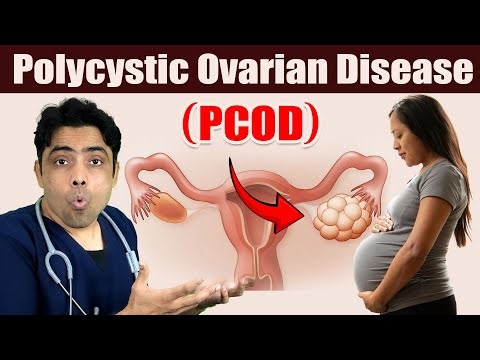 PCOD : Polycystic Ovarian Disease