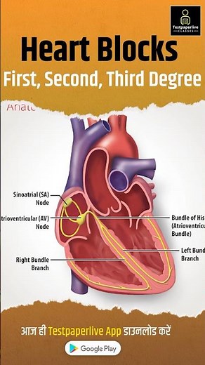 Heart Blocks Explained - First, Second, Third Degree #heartblocks #ecg #heart #shorts #block #ekg