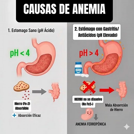 CAUSAS de ANEMIA que debes CONOCER