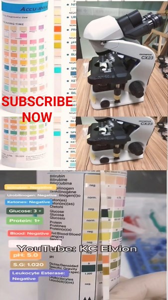 Urinalysis Procedure: Biochemistry and Microscopy. Yeast, Epithelial, Blood cells and urine crystals