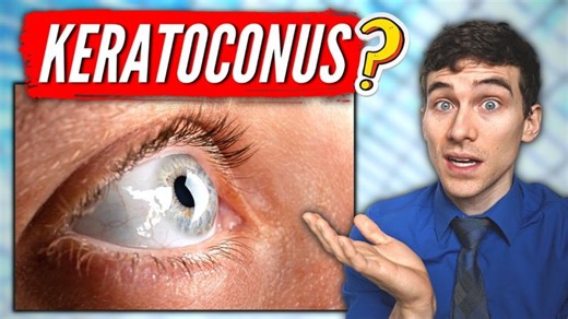 What is Keratoconus? (Keratoconus Eye Disease Explained) | Vanessa McCarthy🍍