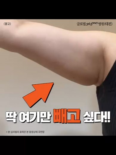 지긋한 팔뚝 지방 없애는 방법!