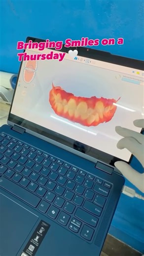 Dr. Aola Imcha on Instagram: "Bringing happy smiles .. !! Braces : What does Braces Correct ? 1. Crooked and crowded teeth 2. Gapped teeth 3. Bite problems - Mal - occlusion 4. Jaw Misalignment. Different types Of Braces. 1. Metal Braces 2. Ceramic Braces 3. Lingual Braces 4. Clear Aligners 5. Invisalign. How Braces work ? 1. Application - brackets are bonded to the teeth and connects them with arch wires, along with springs and elastics . 2. Pressure - the wire creates gentle force, encouraging