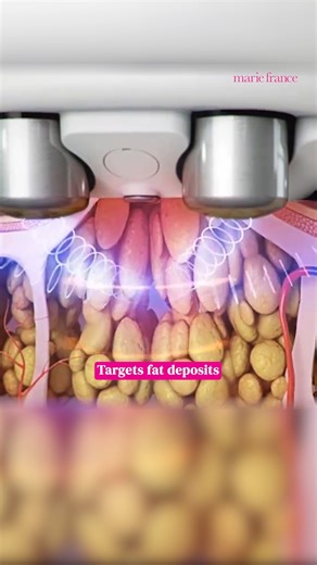 Ever wondered what it’s like to visit Marie France for the first time? Watch as this client shares his experience straight from his first day at the center. From consultation to treatment–hear why he’s already planning the next session! Want to get started on your own Marie France journey? Let’s talk! | Marie France