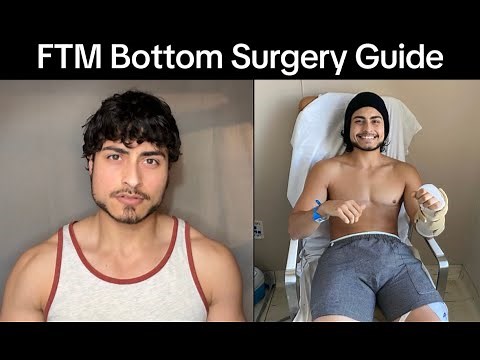 FTM Bottom Surgery Guide | RFF Phalloplasty