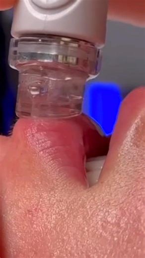 Wait until you see the glow at the end, its a combo of healthy and beautiful skin.