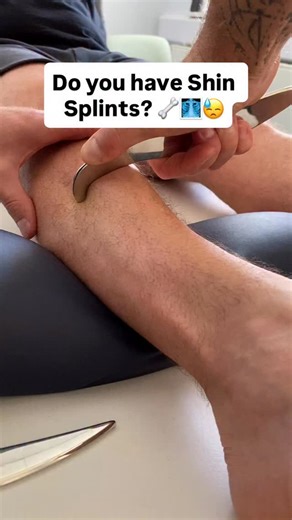 🎯 Treating Shin Splints with IASTM: Pin & Stretch Method 💪 👉Struggling with shin splints? 🏃‍♂️ The pin and stretch technique using IASTM can help restore function and reduce pain. 1️⃣ Pin: Apply targeted pressure to a specific area of restriction or tightness using the IASTM tool. This locks the tissue in place. 2️⃣ Stretch: While maintaining the pressure, guide the muscle through its range of motion to stretch and release the surrounding fascia and tissue adhesions. 📚Why It Works • Release