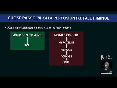 L'échographie doppler en obstétrique : épisode 03 - Intéret du doppler