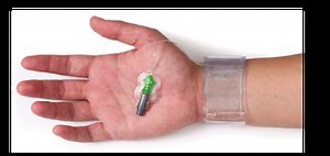 TR-band efter koronarangiografi via a. radialis - Kardiologi.se