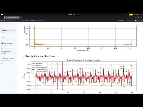 ECG Analysis Dashboard