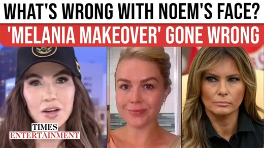 Kristi Noem's 'new face' breaks the internet, plastic surgeon reacts to Botox claims