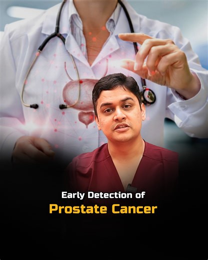 Prostate cancer is now the second most commonly diagnosed cancer among men in India. What makes it concerning is that early symptoms are often subtle and mistaken for routine urinary problems. Persistent UTI-like symptoms, burning or discomfort while passing urine, frequent urination, or a weak urine stream should never be ignored. These may seem minor, but they can be early warning signs that need medical attention. Early prostate cancer screening, including PSA testing and clinical evaluation,
