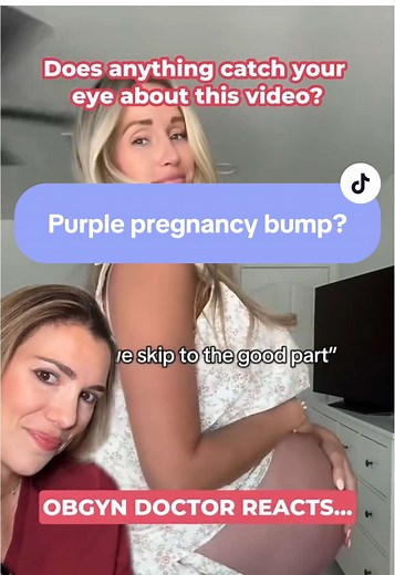 Why Is Your Pregnancy Bump Turning Purple?