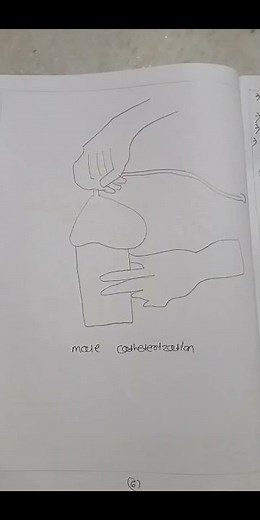 Catheterization procedure step by step 🚑 | Nursing skill made easy 💉 #nursingstudent #ytshorts