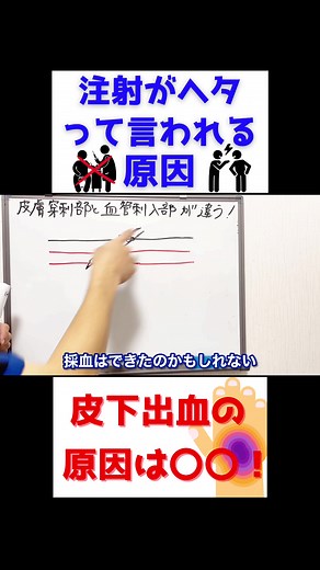 注射がヘタって言われる原因、皮下出血の原因は○○。 #採血コツ #看護師あるある #止血#注射コツ