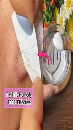 Try this DIY homemade method to remove blackheads and whiteheads naturally #skincare #beauty | Divine Beauty Tips