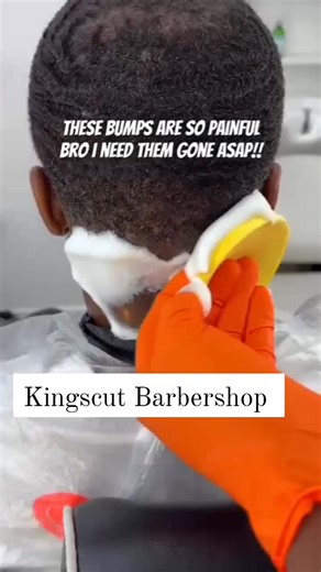 Get rid of bumps! Start your treatment sessions with us at Kingscut Barbershop. Record improvement in 3 weeks time! Call us on 0759805634. | Kingscut Barbershop