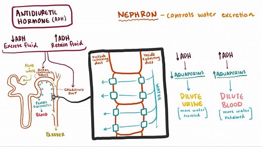 Video: Syndrome of inappropriate antidiuretic hormone secretion (SIADH) - Video Explanation! | Osmosis | Osmosis