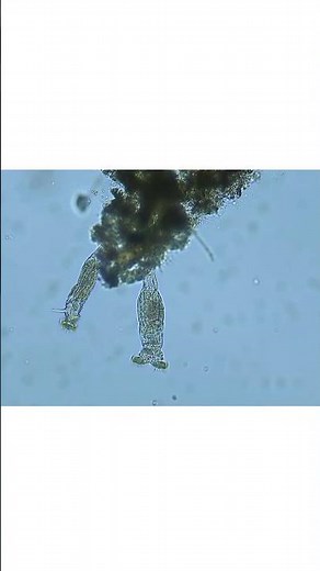 Rotifer Details Through Different Microscopic Filters 🔬✨ #microscopy #nature #shorts