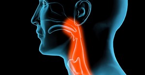 Faringitis crónica: Causas y tratamientos - CIO Salud