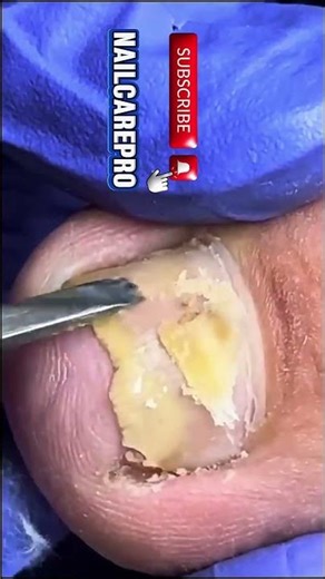 Nail Cutting & Cleaning at Home | Easy & Clean Method! #nails #cleaning