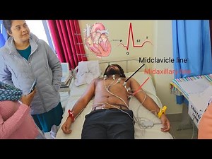 How to Read an ECG | Complete Beginner’s Guide