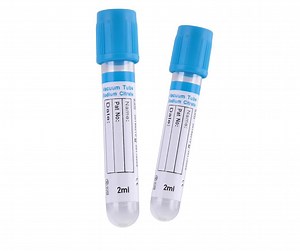 [Hot Item] PT Tube Vacuum Blood Collection Tubes Sodium Citrate Tube, Glass Tubes