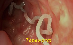 Top 10 Terrifying Parasites That Could Be Inside You