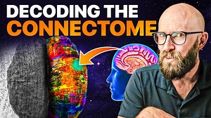 Connectome research aims to chart every neural connection