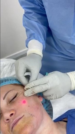 On m’aspire le double menton !😨