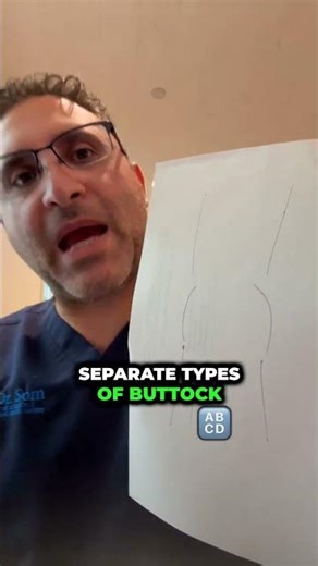 Body Contouring Shapes Explained Beverly Hills