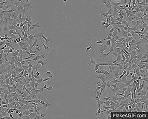 Cell Migration on Essen IncuCyte on Make a GIF
