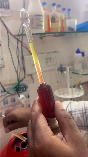 How to test fat in milk by gerber method #shortvideo #dairyfarm #laboratory #milk