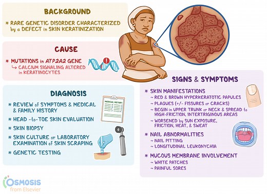 Darier Disease: What It Is, Causes, Signs and Symptoms, and More  | Osmosis