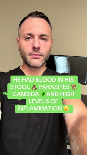 He had seen multiple GI doctors for his recurring gut issues and they still weren’t able to help him discover what was causing his hemorrhoids and other issues! • Check out what we found! #constipation #guthealth #parasites #candida #hemorrhoid