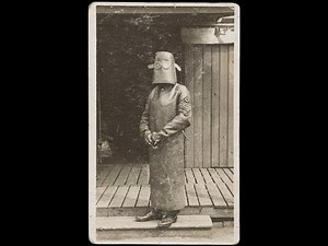 12 Vintage Photos That Show Medical Treatments in the Past Were Horrible