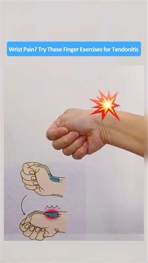 Wrist Pain Every Day? Try These 4 Simple Finger Exercises to Relieve Tendonitis Fast