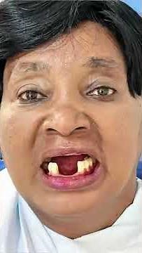 Everything You Need to Know About Dental Dentures | Types, Benefits & Care